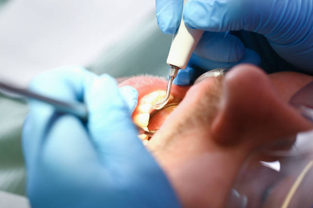 Best Pediatric Emergency Dentist in Marysville, WA