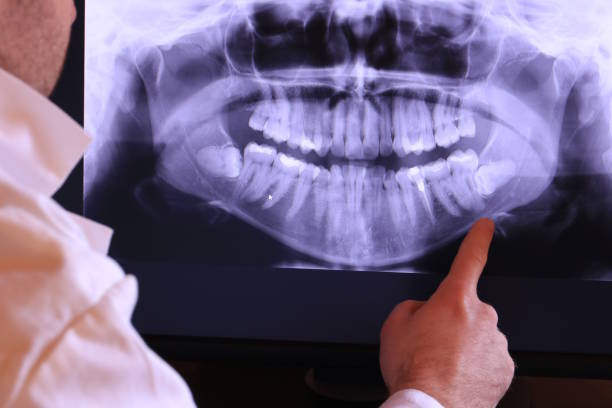 Best Weekend Emergency Dentist in Marysville, WA